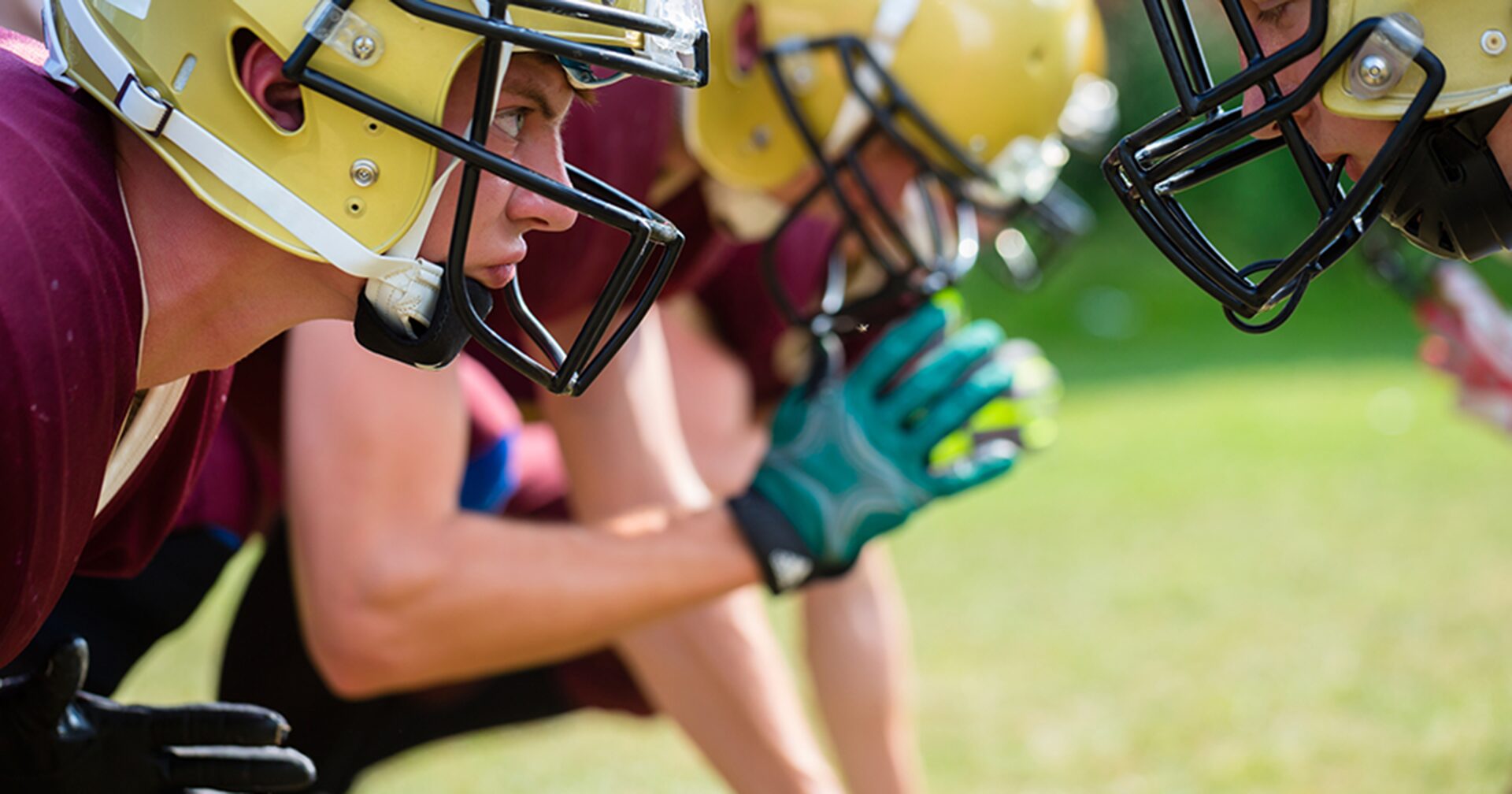 VIAマウスピース製品画像(イメージ)